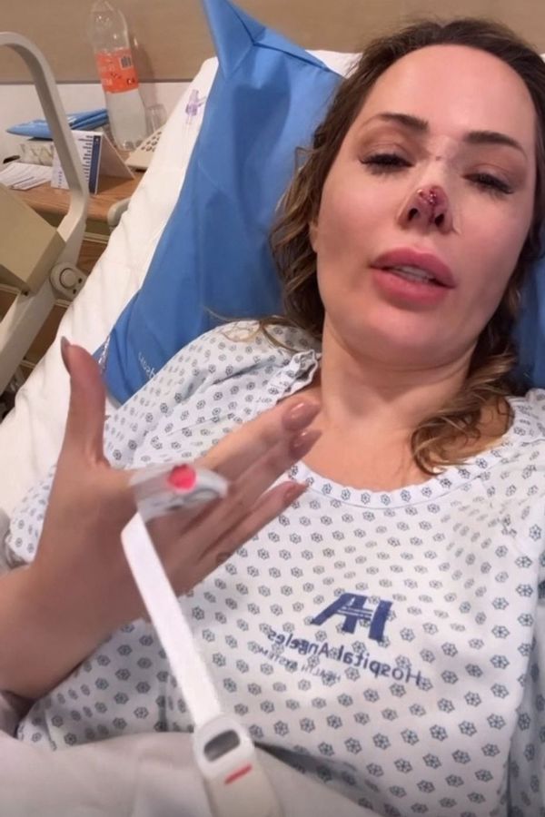 Influencerku brutálně napadl pes, bála se, že přijde o kus obličeje: S traumatem se vyrovnala zvláštním způsobem - fotka 1/1